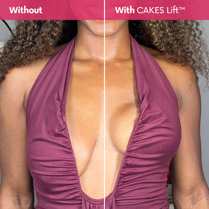 CAKES Lift™
